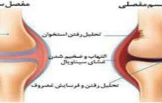 مسابقه کتابخوانی شناخت بیماری روماتیسم